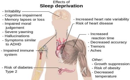 [This diagram outlines the various physical and mental effects of sleep deprivation on the human body. Key effects include irritability, cognitive impairment, memory lapses or loss, impaired moral judgement, severe yawning, hallucinations, symptoms similar to ADHD, and an impaired immune system. Additional risks are diabetes type 2, increased heart rate variability, risk of heart disease, increased reaction time, decreased accuracy, tremors, aches, growth suppression, risk of obesity, and decreased body temperature.]